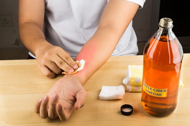 vinegar against itching